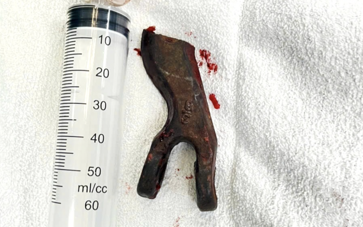 Driver Injured by Broken Chain While Towing Truck Through Mud