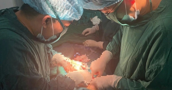 Timely Surgery Saves 28-Week Pregnant Woman from Ovarian Cyst Torsion